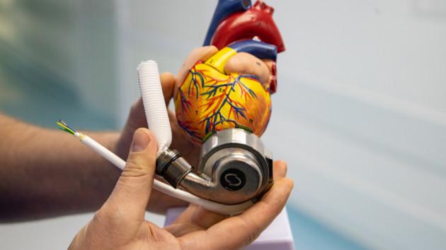 Стаття В Александровской больнице Киева впервые провели операцию по имплантации механического сердца Ранкове місто. Донбас
