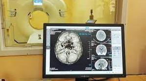 Стаття В дитячій лікарні Одеси встановили комп’ютерний томограф (фото) Ранкове місто. Донбас